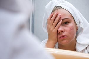 Skin Conditions and Your Mental Health